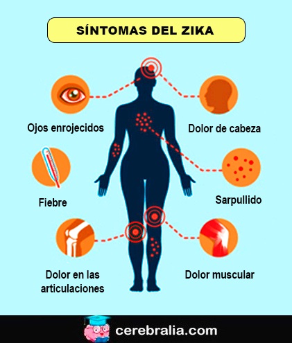 Síntomas del Zika